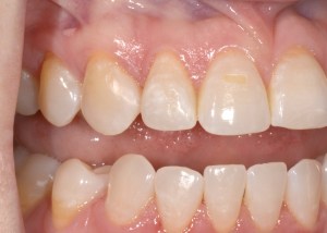 Smile Gallery After