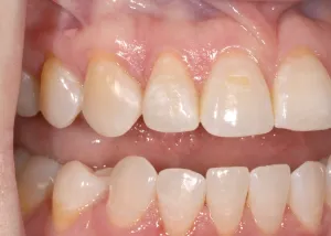 Smile Gallery After