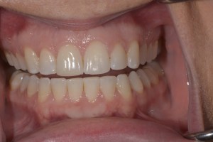 Smile Gallery After