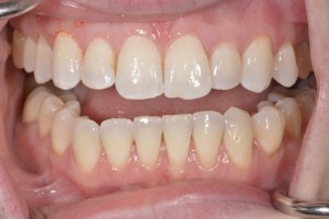 Smile Gallery Before