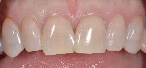 Smile Gallery After