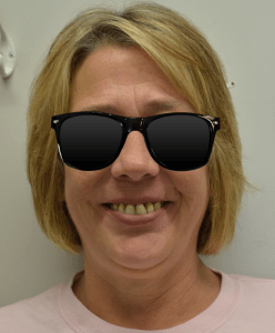 Smiling woman before dental restoration