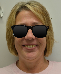 Smiling woman before dental restoration